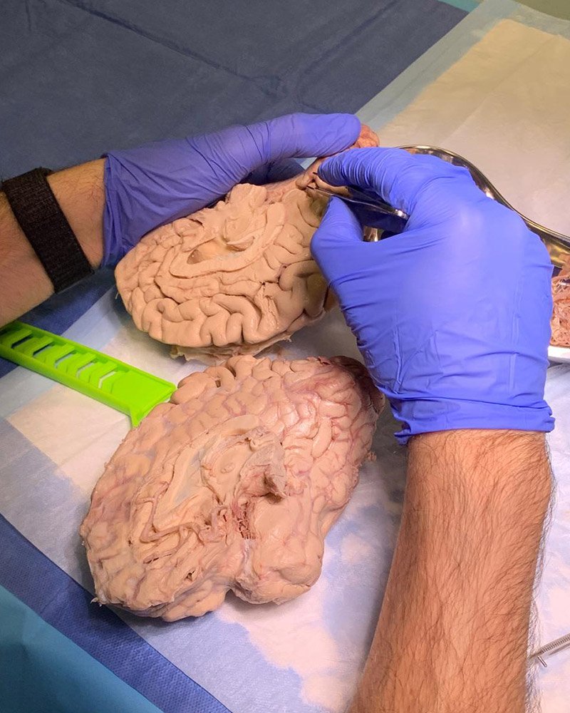 NeuroConnect